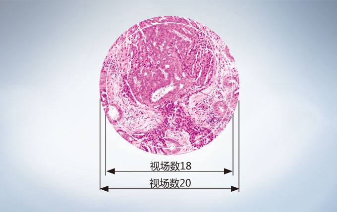 OLYMPUS奥林巴斯 CX23生物显微镜 【三目|双目|荧光|相差】-普赫光电